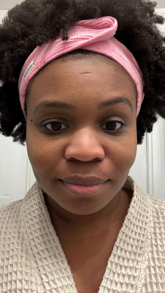 Jessica Cruel after Shani Darden Lactic Acid Exfoliating Mask