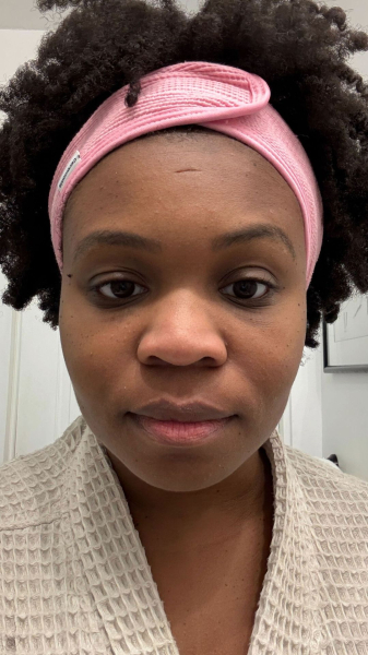 Jessica Cruel before applying the Shani Darden Lactic Acid Exfoliating Mask